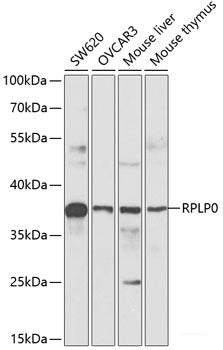 Western blot analysis of extracts of various cell lines using RNASEH2C Polyclonal Antibody at dilution of 1:3000.