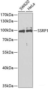 Western blot analysis of extracts of Mouse skeletal muscle using TFAP2B Polyclonal Antibody at dilution of 1:3000.
