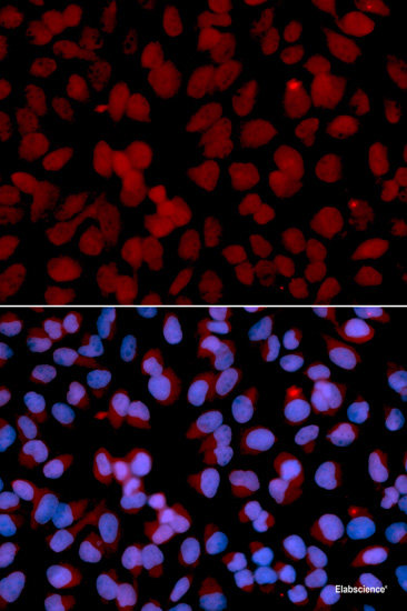 Western blot analysis of extracts of various cell lines using SPSB1 Polyclonal Antibody at dilution of 1:1000.