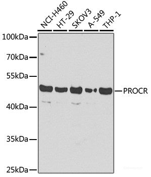 Western blot analysis of extracts of various cell lines using MICA Polyclonal Antibody at dilution of 1:1000.