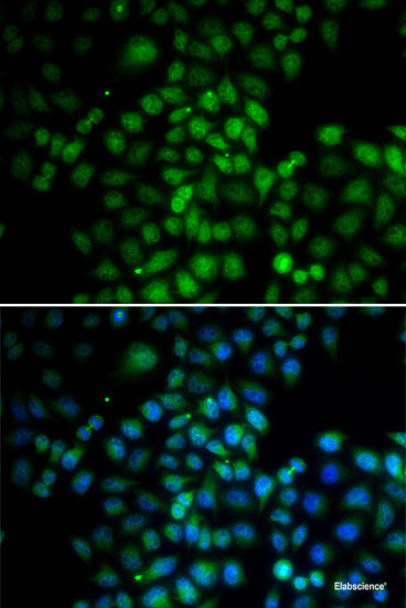 Western blot analysis of extracts of Mouse liver using HIC1 Polyclonal Antibody at dilution of 1:3000.