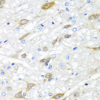 Immunohistochemistry of paraffin-embedded Rat lymph node using SNAP23 Polyclonal Antibody at dilution of 1:100 (40x lens).