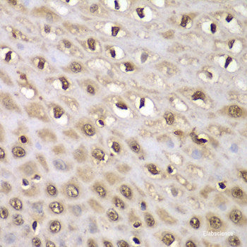 Immunofluorescence analysis of U2OS cells using ADA Polyclonal Antibody at dilution of 1:100. Blue: DAPI for nuclear staining.