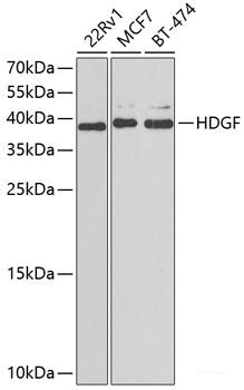 Immunohistochemistry of paraffin-embedded Rat brain using KNG1 Polyclonal Antibody at dilution of 1:100 (40x lens).