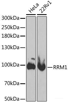 Immunohistochemistry of paraffin-embedded Rat testis using P2RY2 Polyclonal Antibody at dilution of 1:100 (40x lens).