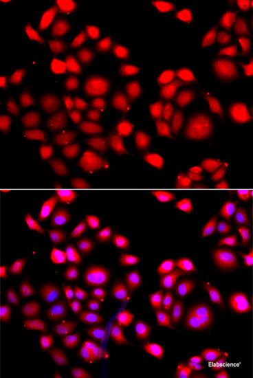 Immunohistochemistry of paraffin-embedded Rat spinal cord using PHLDA2 Polyclonal Antibody at dilution of 1:100 (40x lens).