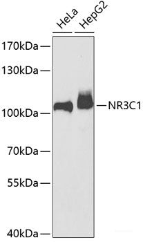 Immunohistochemistry of paraffin-embedded Human colon using MCAM Polyclonal Antibody at dilution of 1:100 (40x lens).