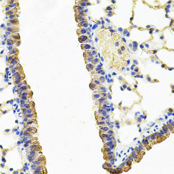 Immunofluorescence analysis of 293T cells using AADAC Polyclonal Antibody at dilution of 1:100 (40x lens). Blue: DAPI for nuclear staining.