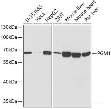 Western blot analysis of extracts of various cell lines using PDE4D Polyclonal Antibody at dilution of 1:1000.