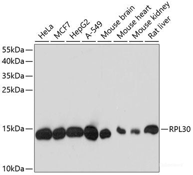 Immunofluorescence analysis of HeLa cells using ANXA5 Polyclonal Antibody