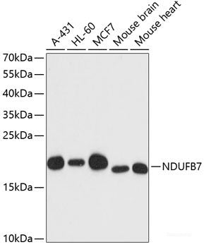 Western blot analysis of extracts of various cell lines using APRT Polyclonal Antibody at dilution of 1:1000.