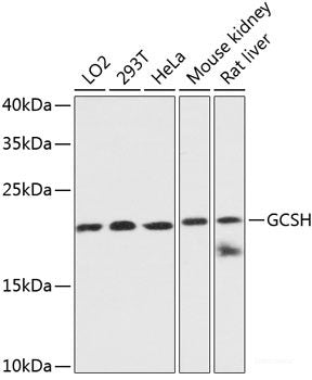 Immunohistochemistry of paraffin-embedded Rat brain using RhoA Polyclonal Antibody at dilution of 1:100 (40x lens).