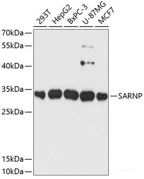 Western blot analysis of extracts of Mouse liver using SLC25A20 Polyclonal Antibody at dilution of 1:1000.