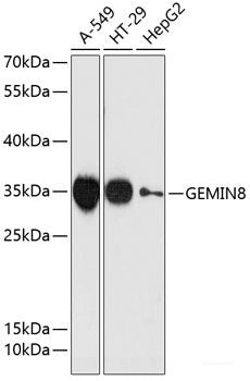 Immunohistochemistry of paraffin-embedded Rat trachea using COMP Polyclonal Antibody at dilution of 1:100 (40x lens).