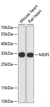 Immunofluorescence analysis of HeLa cells using CYP1B1 Polyclonal Antibody at dilution of 1:100 (40x lens). Blue: DAPI for nuclear staining.
