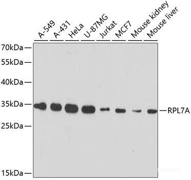 Immunohistochemistry of paraffin-embedded Rat brain using CYP17A1 Polyclonal Antibody at dilution of 1:100 (40x lens).