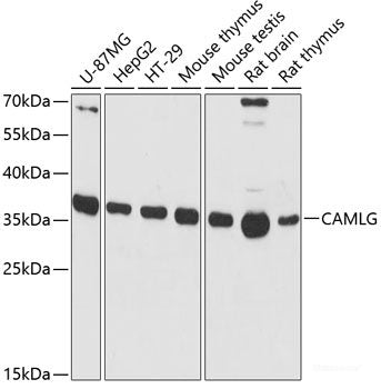 Immunohistochemistry of paraffin-embedded Human liver using DBH Polyclonal Antibody at dilution of 1:200 (40x lens).