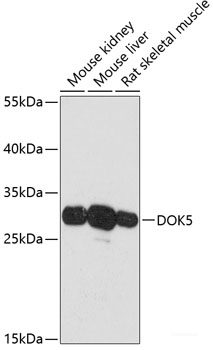 Western blot analysis of extracts of Mouse kidney using EBF1 Polyclonal Antibody at dilution of 1:1000.