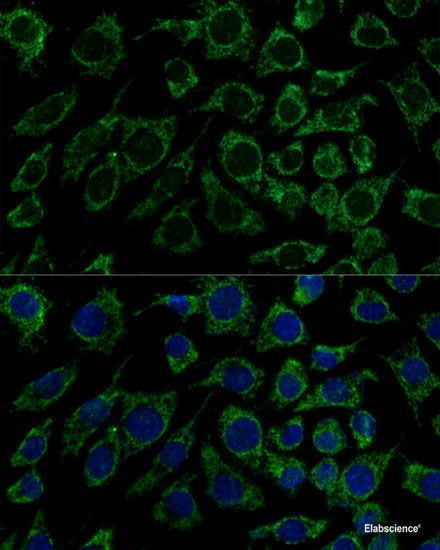 Immunofluorescence analysis of HeLa cells using GRIA3 Polyclonal Antibody
