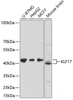 Immunohistochemistry of paraffin-embedded Rat brain using GRIN1 Polyclonal Antibody at dilution of 1:100 (40x lens).