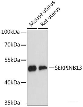 Immunohistochemistry of paraffin-embedded Rat ovary using HLA-DPB1 Polyclonal Antibody at dilution of 1:100 (40x lens).
