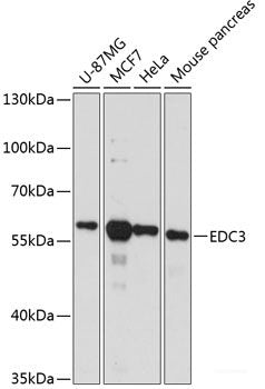 Western blot analysis of extracts of various cell lines using FGB Polyclonal Antibody at dilution of 1:1000.