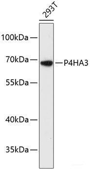 Western blot analysis of extracts of Mouse liver using KTN1 Polyclonal Antibody at dilution of 1:1000.
