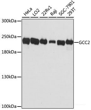 Immunofluorescence analysis of U2OS cells using NOS2 Polyclonal Antibody at dilution of 1:100. Blue: DAPI for nuclear staining.