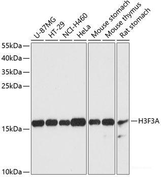 Immunohistochemistry of paraffin-embedded Rat brain using OTX2 Polyclonal Antibody at dilution of 1:100 (40x lens).