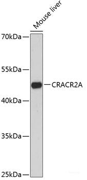 Western blot analysis of extracts of various cell lines using PSMA5 Polyclonal Antibody at dilution of 1:1000.