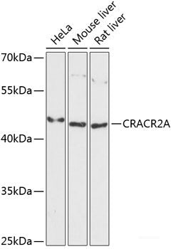Immunofluorescence analysis of MCF-7 cells using PTS Polyclonal Antibody