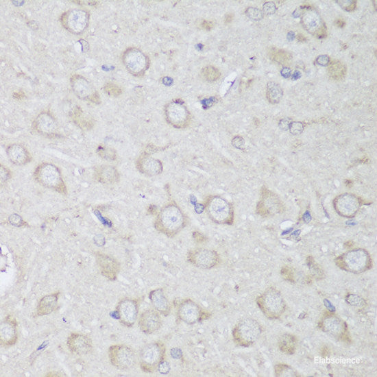 Immunofluorescence analysis of C6 cells using PTPN22 Polyclonal Antibody at dilution of 1:100. Blue: DAPI for nuclear staining.
