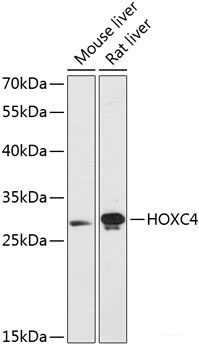 Immunofluorescence analysis of U2OS cells using TPMT Polyclonal Antibody