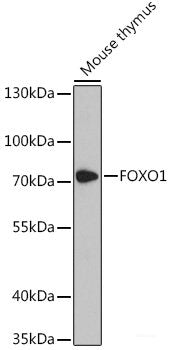 Western blot analysis of extracts of Mouse liver using FGF23 Polyclonal Antibody at dilution of 1:1000.