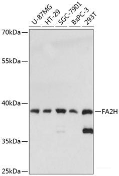 Immunohistochemistry of paraffin-embedded Rat spleen using IKBKE Polyclonal Antibody at dilution of 1:100 (40x lens).