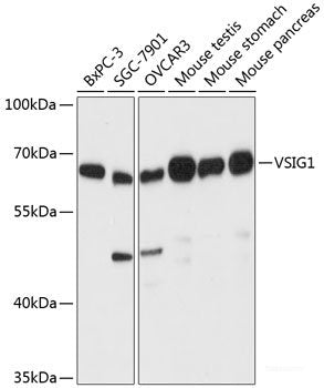 Immunofluorescence analysis of HeLa cells using CACNG2 Polyclonal Antibody