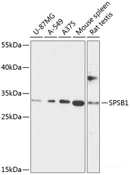 Western blot analysis of extracts of various cell lines using HLA-DPB1 Polyclonal Antibody at dilution of 1:1000.