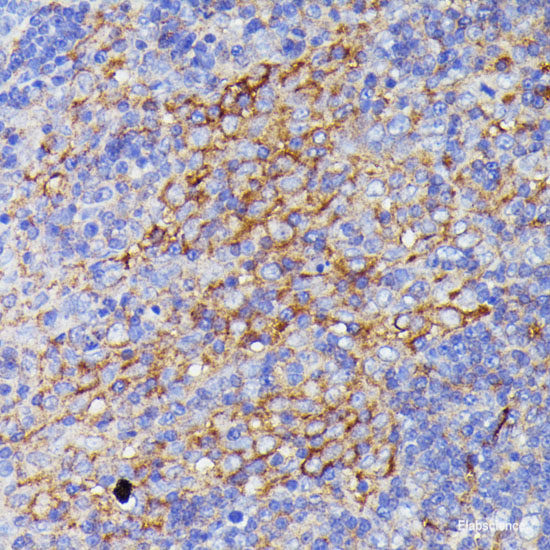 Immunofluorescence analysis of A549 cells using PRKAG3 Polyclonal Antibody