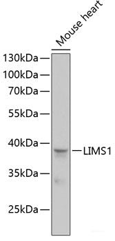 Immunohistochemistry of paraffin-embedded Human stomach using SETD5 Polyclonal Antibody at dilution of 1:100 (40x lens).