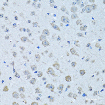 Immunohistochemistry of paraffin-embedded Human appendix using TGFBR2 Polyclonal Antibody at dilution of 1:100 (40x lens).