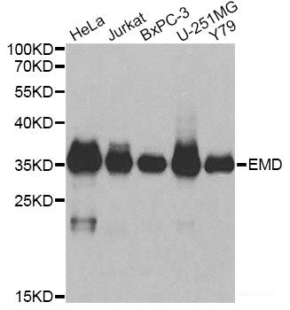 Western blot analysis of extracts of various cell lines using VPS37A Polyclonal Antibody at dilution of 1:1000.