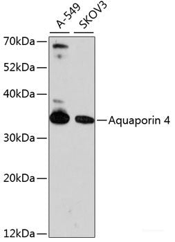 Immunofluorescence analysis of A549 cells using PLCXD2 Polyclonal Antibody