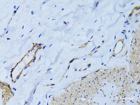 Western blot analysis of extracts of MCF7 cells using GATC Polyclonal Antibody at dilution of 1:1000.