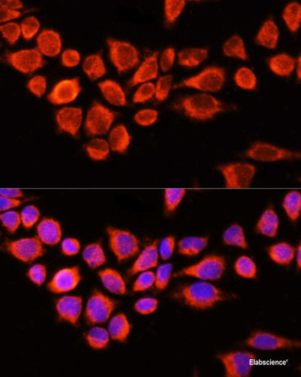 Immunohistochemistry of paraffin-embedded Human uterus using ESRRA Polyclonal Antibody at dilution of 1:200 (40x lens).