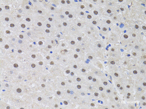 Immunofluorescence analysis of HeLa cells using MSR1 Polyclonal Antibody