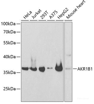 Immunofluorescence analysis of U2OS cells using RUVBL1 Polyclonal Antibody at dilution of 1:100. Blue: DAPI for nuclear staining.