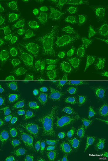 Immunohistochemistry of paraffin-embedded Human liver using APOA5 Polyclonal Antibody at dilution of 1:100 (40x lens).