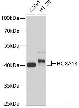 Immunohistochemistry of paraffin-embedded Human prostate using SELP Polyclonal Antibody at dilution of 1:100 (40x lens).