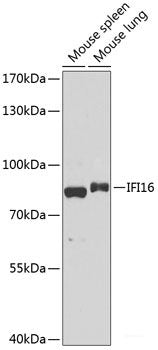 Immunohistochemistry of paraffin-embedded Rat brain using RPL21 Polyclonal Antibody at dilution of 1:100 (40x lens).