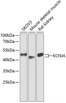 Western blot analysis of extracts of various cell lines using CNTN6 Polyclonal Antibody at dilution of 1:1000.